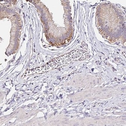 RSRP1 Antibody, Novus Biologicals:Antibodies:Primary Antibodies